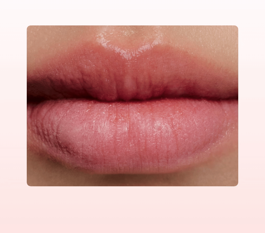 masque lèvres abib coréen PDRN 11 g