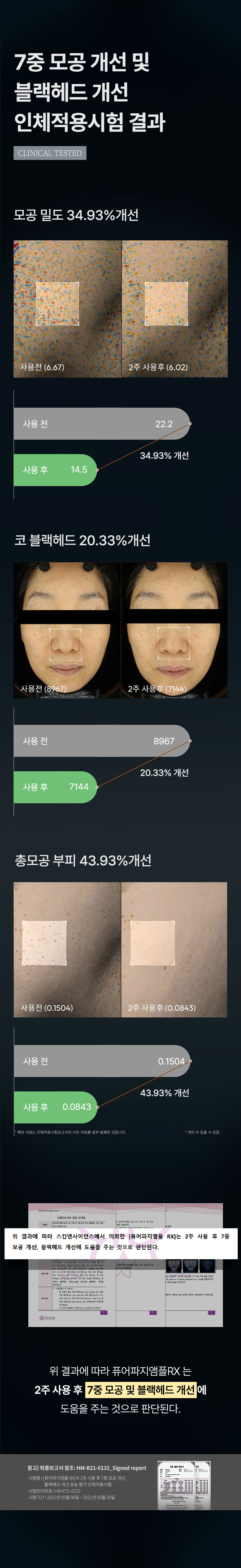 악세사리 -S70L1